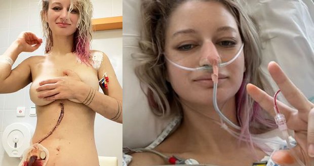 Další boj o život fotografky Lucie (31): Nádorové ložisko, operace i slova o smrti