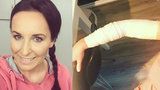 Moderátorka Šilhánová se zafačovanou rukou: Bolí to jako prase! Co se stalo?