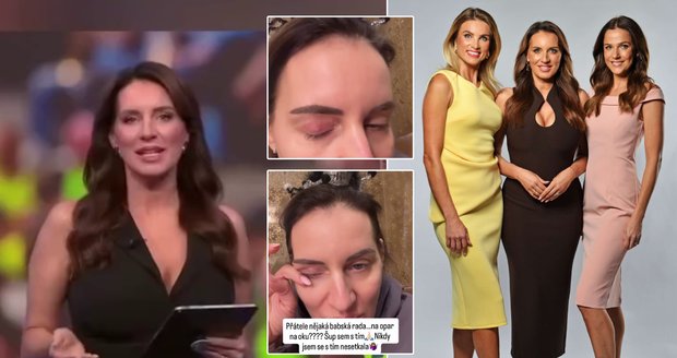 Nepříjemný zdravotní problém Lucie Šlégrové - opar na oku