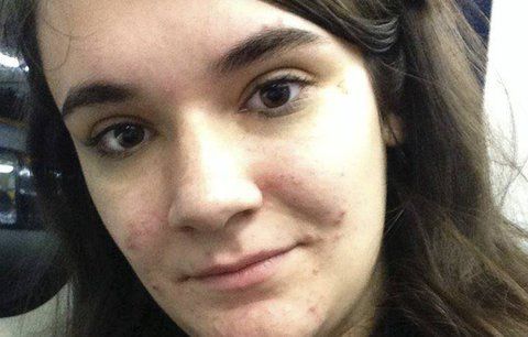 Už v osmi letech měla bulimii a anorexii! Chtěla totiž vypadat jako panenka Barbie