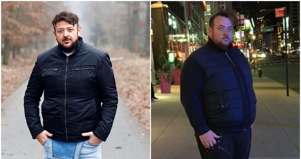 Herec Lukáš Malínek dokázal zhubnout 127 kilogramů. Teď ho čekají tři operace, během kterých mu lékaři plánují odstranit sedm kilo přebytečné kůže.