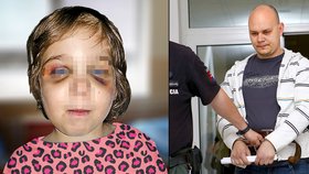 Známého slovenského kameramana zatknuli kvůli podezření z týrání dcerky své přítelkyně.