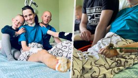 Kateryna (35) během ostřelování přišla nejen o nohu, ale i nadcházející dítě.