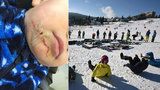 Chlapečka (2) zranila uvolněná lyžařská branka! Rodiče shání svědky 