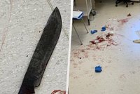 Šílenec napadl personál českobudějovické nemocnice mačetou: Čtyři zranění!