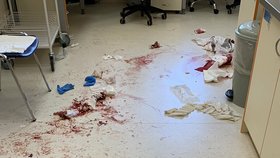 Ozbrojený muž napadl personál nemocnice v Českých Budějovicích mačetou.