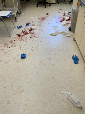 Ozbrojený muž napadl personál nemocnice v Českých Budějovicích mačetou.