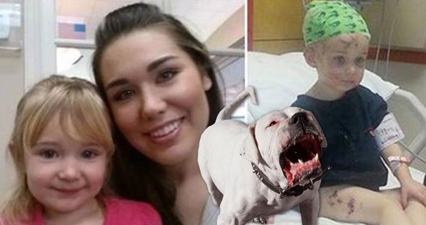 Matka zachránila svoji dcerku ze spárů pitbulla tím, že mu ukousla ucho.