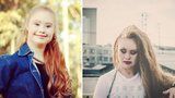 Madeline Stuart: První modelka s Downovým syndromem