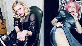 Madonna se pochlubila jizvou! Má za sebou operaci?