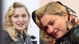 Otřesná plastika: Madonna (55) s tvářemi plnými silikonu vypadá jako sysel