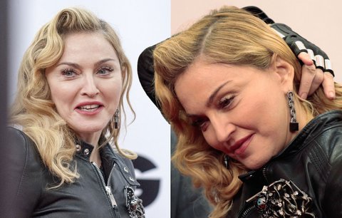Otřesná plastika: Madonna (55) s tvářemi plnými silikonu vypadá jako sysel