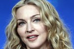 Madonna se bojí fanoušků. Zřídila kvůli nim sterilizační tým!