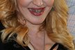 Madonna vycenila v Itálii zlaté zuby