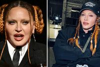 Madonna (64) přiznala plastiku! Otok splaskl a teď? Jsem roztomilá, tvrdí zpěvačka