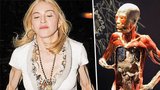 Šlachovitá Madonna: Utekla z výstavy Bodies?