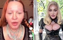 Potupa Madonny (65): Po operaci zadku vypadá jako mravenec