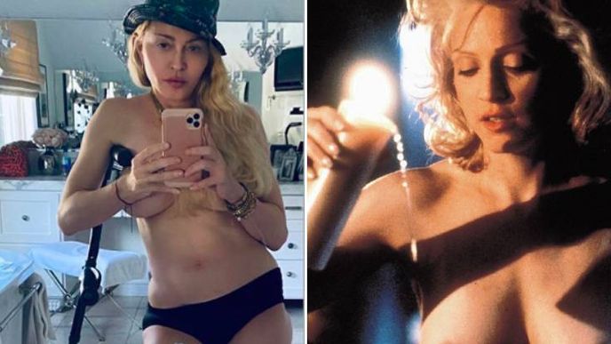 Madonna předtím, než se stala závisla na plastických operacích