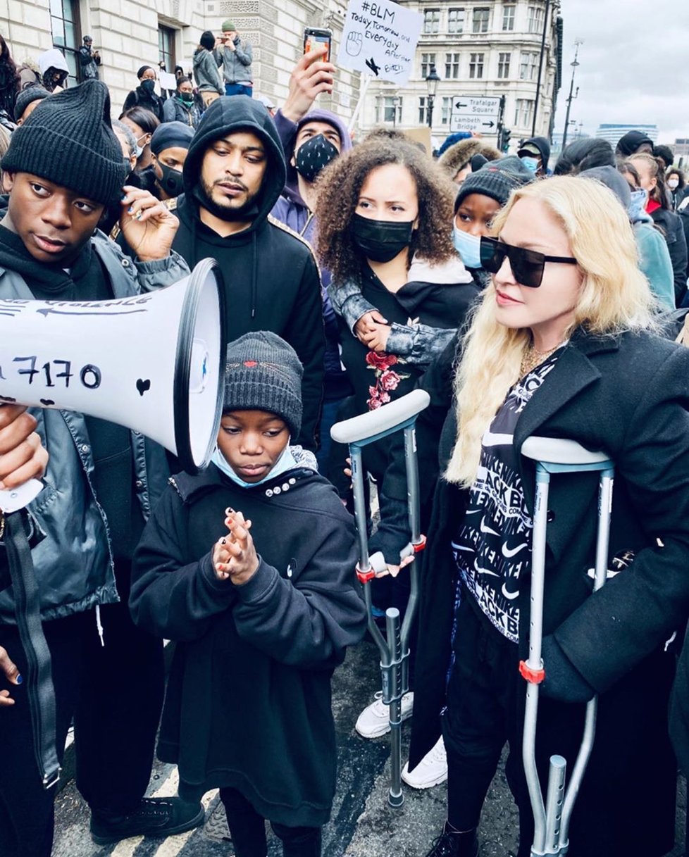 Madonna přišla na protest o berlích