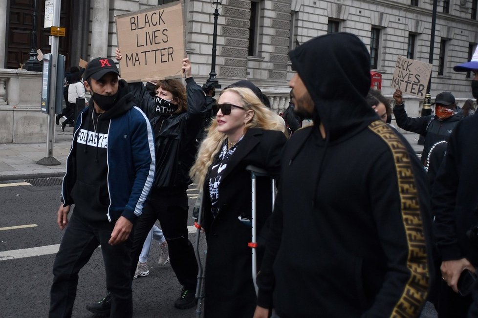 Madonna přišla na protest o berlích