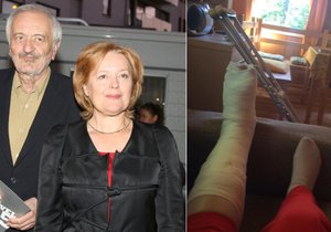 Magda Vášáryová si přivodila zlomeninu kotníku.
