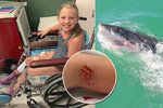 Dívku (9) na mělčině napadl žralok: Rodina si myslela, že zranění předstírá, dokud se voda nezbarvila krví!