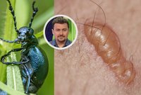 Rodiče malých dětí děsí jedovatý brouk: Puchýře, krev v moči, kóma? Entomolog vysvětluje!