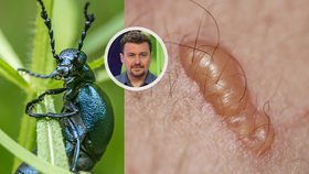 Rodiče malých dětí děsí jedovatý brouk: Puchýře, krev v moči, kóma? Entomolog vysvětluje!