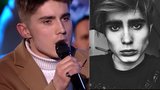 Děsivá proměna kontroverzního finalisty SuperStar: Vystouplé kosti vystrašily fanoušky!