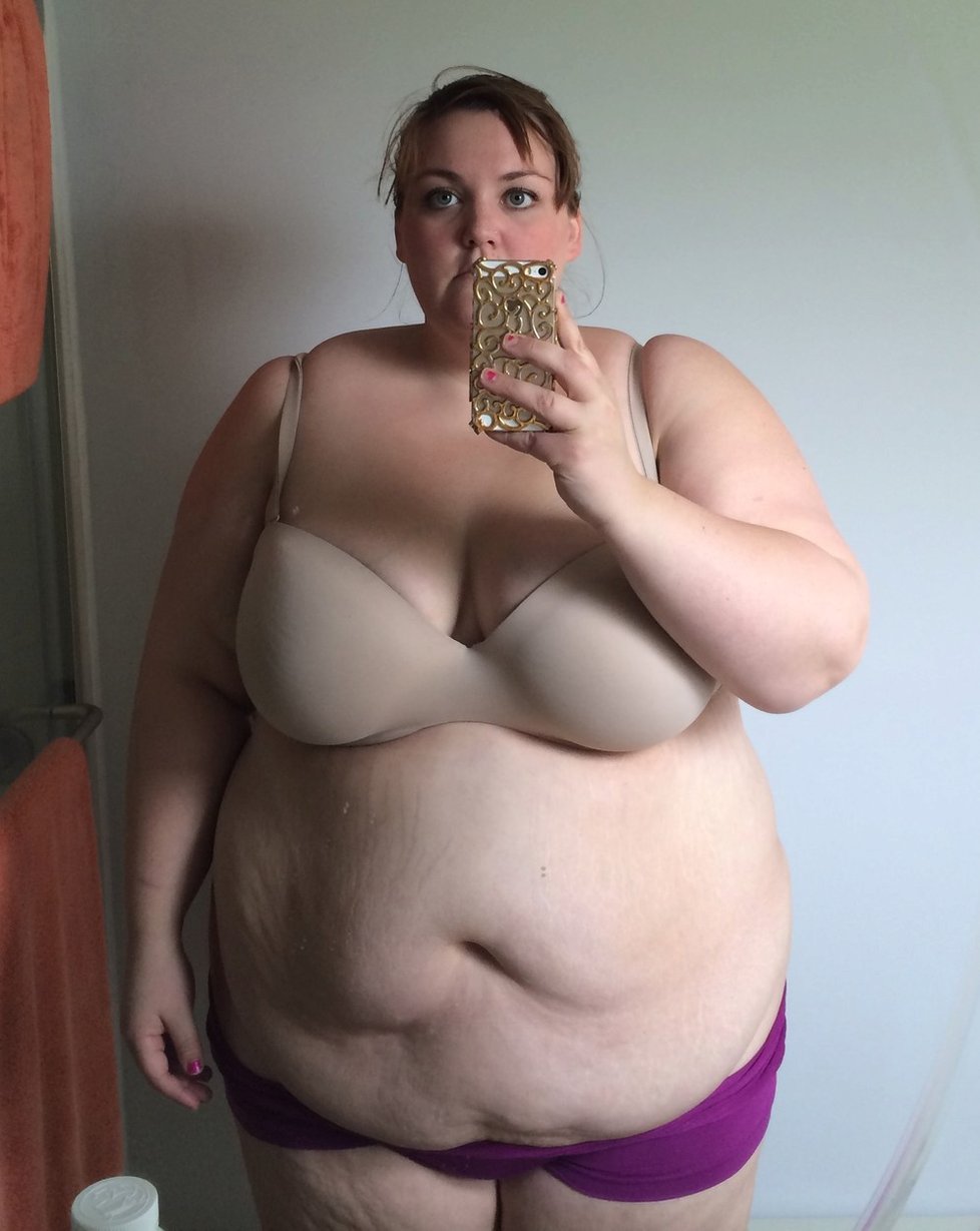 Když šla Mallory na bariatrickou operaci, vážila 165 kilogramů.