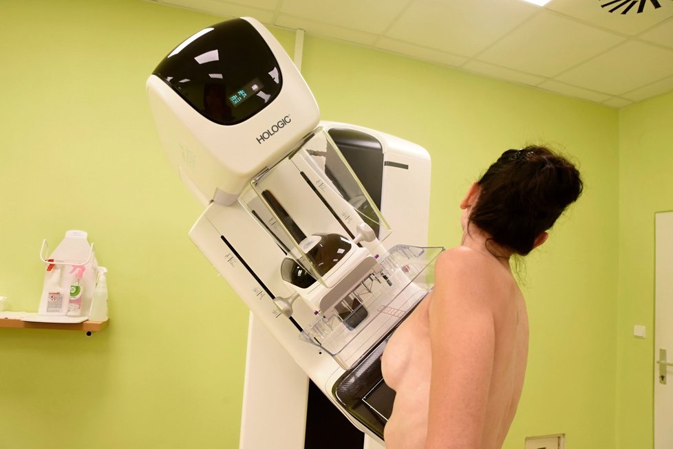Nejmodernější mamograf uvedli do provozu ve Slezské nemocnici v Opavě minulý týden.