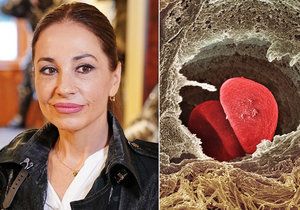 Naděje pro ženy s rakovinou prsu: Genomické testování podstoupila i herečka Michaela Kuklová