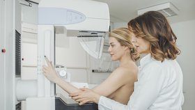 Překonejte mýty o mamografu. Vyšetření nebolí.