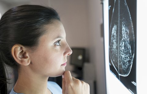 Rakovinu prsu odhalí umělá inteligence! Lépe než lékaři, ukázala studie