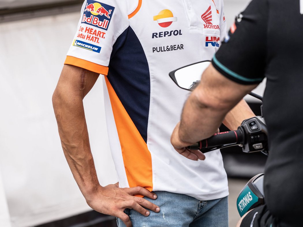 Zdravotní situace pravé ruky Marka Marqueze je předmětem častých debat před začátkem sezony MotoGP