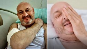 S rakovinou bojující slovenský herec po chemoterapii zkolaboval: Museli ho křísit!