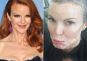 Marcia Cross přiznala rakovinu konečníku.