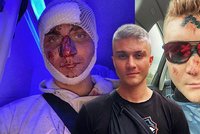 Youtuber Marek Datel málem přišel o život! Fotka zkrvaveného obličeje děsí