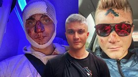 Youtuber Marek Datel málem přišel o život! Fotka zkrvaveného obličeje děsí