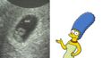 Plod vypadající jako Marge Simpsonová