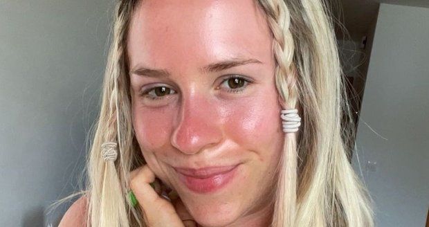 Mariana Prachařová se na dovolené v Chorvatsku spálila