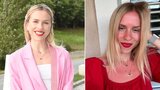 Prachařová bojující s anorexií: Rudá jako rak! Spálila se na dovolené