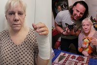 Pojkarová je po operaci, vyhráno nemá: Bojí se návratu nádoru!