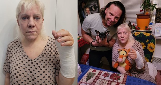 Marie Pojkarová je po operaci