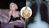 Marilyn Monroe se narodila před 100 lety: Aukce odhalila rentgen pánve a hrudníku!