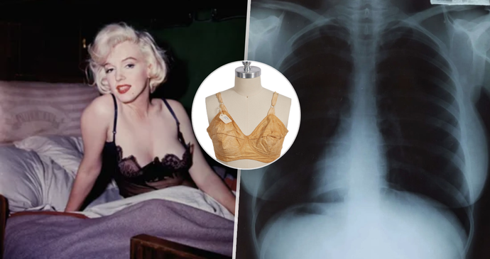 Rentgenové snímky z aukce k výročí narození Marilyn Monroe