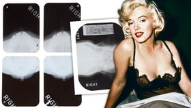 Marilyn Monroe neoplývala dokonalou krásou od přírody. Musela si pomoct plastikami.