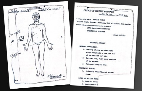 Pitevní zpráva uvedla, že Monroe měla v krvi smrtelnou kombinaci léků na spaní a proti bolesti. Součástí spisu je i nákres jizev a zranění na kůži Monroe
