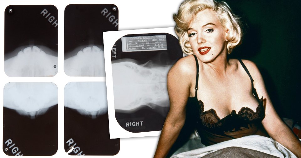 Marilyn Monroe neoplývala dokonalou krásou od přírody. Musela si pomoct plastikami.