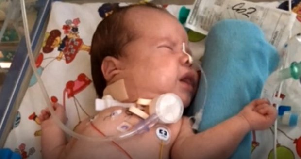 Tříměsíční Mário nemůže dýchat kvůli nádoru! Zachránit ho může jen operace v Praze